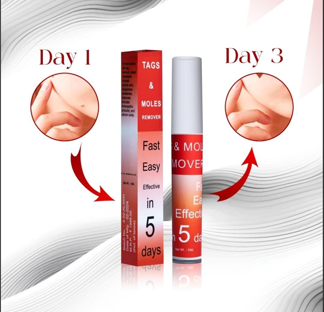 TagMo™ - Tags & Moles Remover (Buy 1 Get 1 Free🔥🔥)