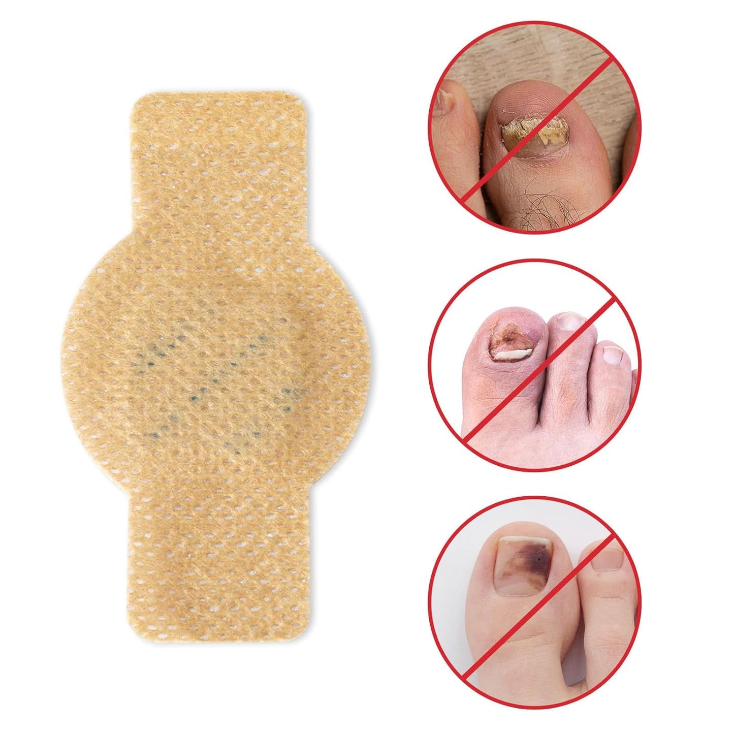 NailHeal - Fungal Nail Patches 🌿💅 ( Buy 1 Get 1 Free🔥🔥)