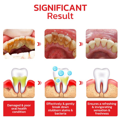 Original™ SP4 Ultra Teeth Whitening Toothpaste (Buy 1 Get 1 Free)