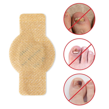 NailHeal - Fungal Nail Patches 🌿💅 ( Buy 1 Get 1 Free🔥🔥)